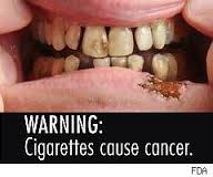 Smoking causes cancer