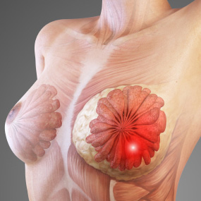 Picture of female breast. Area of where most Breast Cancers are found. This can occur in both males and females.
