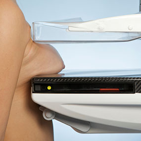 Picture of taking a mammogram. Women are recommended to have a mammogram every 12 - 36 months like this. New study shows this is LIKELY to cause Breast Cancer rather than detect it.