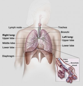 This is where the lungs are in the body, showing the areas where lung cancer is likely to appear. Firstly in the lung itself and then traveling to those parts of the body closest to the lungs.